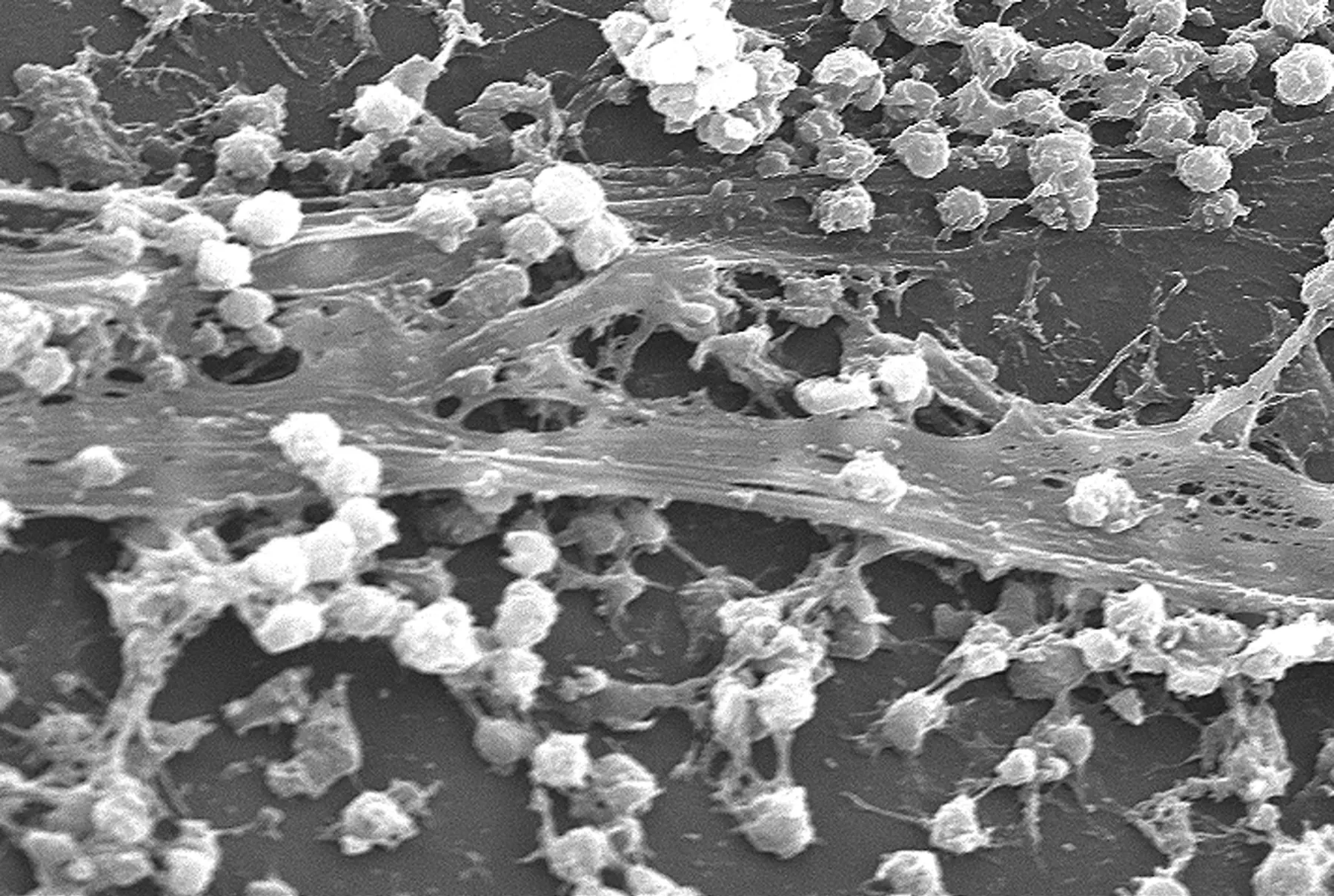 Biofilm - màng sinh học
