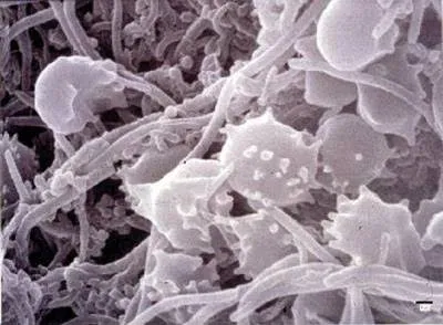 Biofilm bacteria